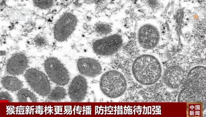 美国猴痘新变异株感染者隔离措施实施，全球防控挑战与应对策略